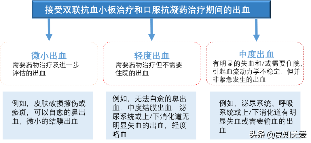 冠状动脉支架植入术